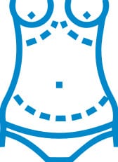 Abdominoplasty (1)
