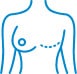 Breast Reconstruction
