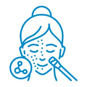 Chemical Peel blue